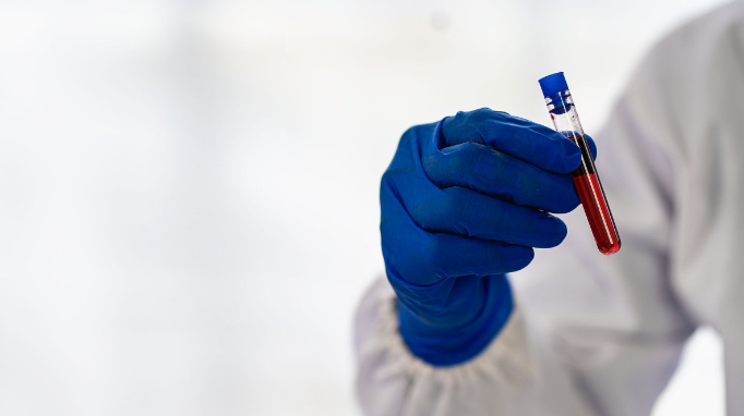 移民体检有哪些必查项目？不合格怎么办